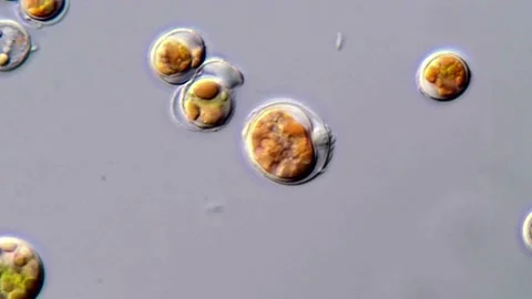 Microalgae Organisms in Water Sample, microscope 1000x 動画素材 310301821