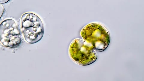 Microalgae under microscope, Cosmarium algae 库存影片 311037630