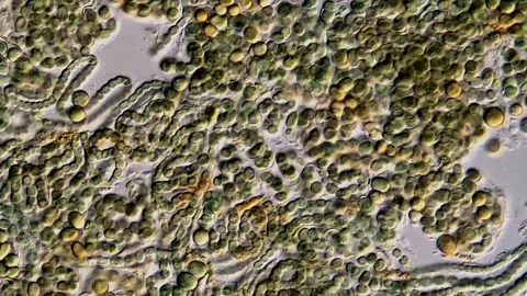 Microalgal, chlorophyta Green algae under microscope view 库存影片 306572463