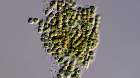 Microalgal, Green algae under microscope Vidéo 306572397