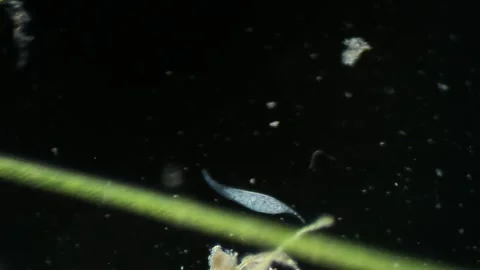 Microbe ciliate Litonotus under Microscope Stock Footage 314635043