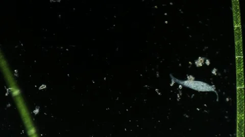 Microbe ciliate Litonotus under Microscope Stock Footage 314635067