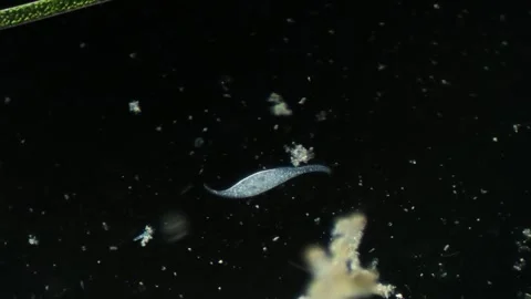 Microbe ciliate Litonotus under Microscope Stock Footage 314635071