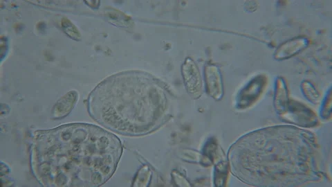 Microbes in a drop of fresh water from a lake. Vorticella (organism) in waste Stock Footage