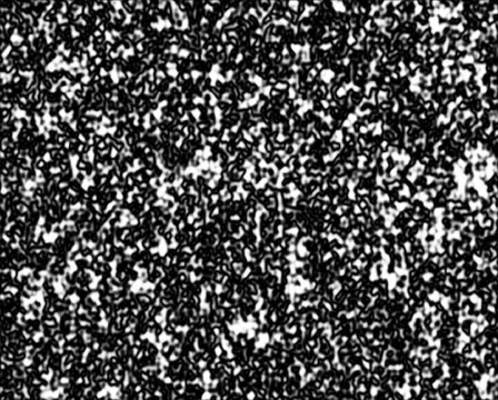 Microbes 库存影片 103843