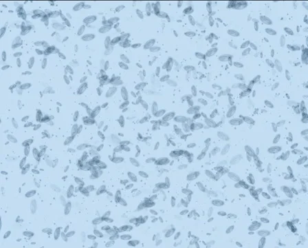 Microbes form Peace PAL Stock Footage 1044602