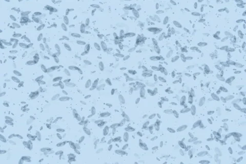 Microbes form Skull and Cross-bone Full NTSC Stock Footage 1044590