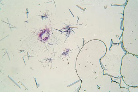 Microbes under microscope 스톡 사진