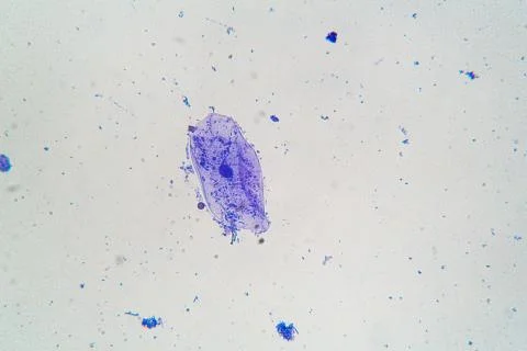 Microbes under microscope Photos