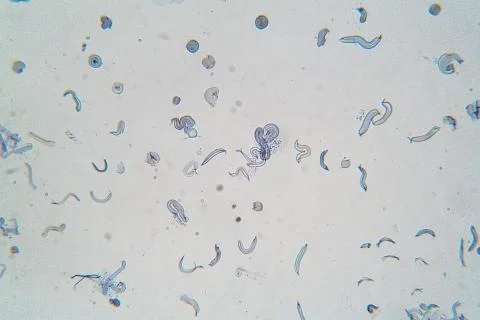 Microbes under microscope 스톡 사진