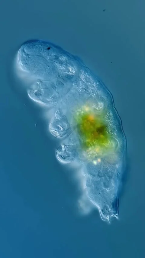 Microbial life activity seen using a microscope Stock Footage 320281041