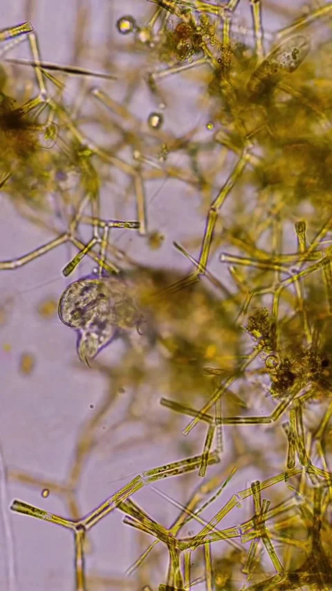 Microbial life activity seen using a microscope Stock Footage 320281129