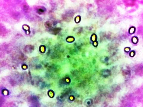 Microbial Life Magnified Under a Microscope Reveals Intricate Structures an.. Foto stock