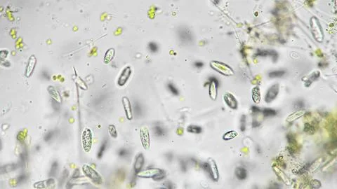 Microbial water life visuals. Microscopic algae and phytoplankton diversity Stock-Fotos