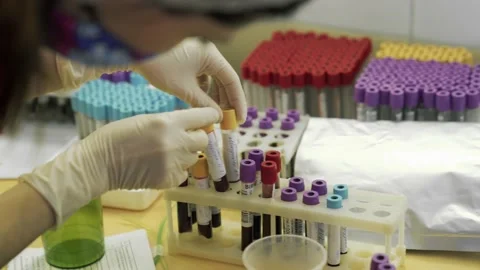 Microbiologist changes the tests with a tube of biological sample contaminated Stock Footage 134338252