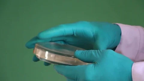 Microbiologist opens the petri dish on the green background Stock Footage 73170724