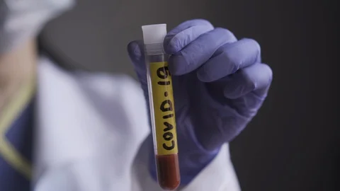 Microbiologist in uniform and disposable gloves. Test tube with carpet sticker Stock Footage 130130596