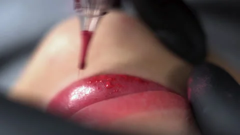 Microblading lip tattoo in a permanent makeup clinic, applying coloring pigment Stock Footage 170691326