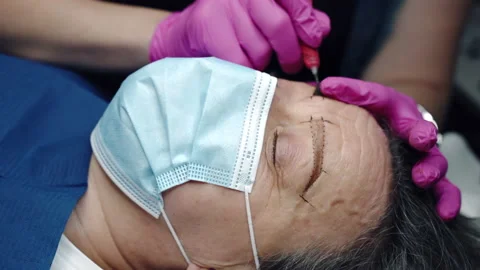 Microblading procedure in beauty salon, correction of permanent eyebrows tattoo Video stock 201402099