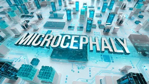 Microcephaly with medical digital technology concept Stock Footage 107024850