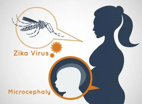 Microcephaly or Abnormal Smallness of the Head Concept. The Zika Fever Virus  Stock Illustration