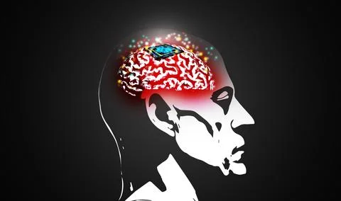 Microchip is implanted in human brain. Neural implants. Brain-computer inte.. イラスト素材