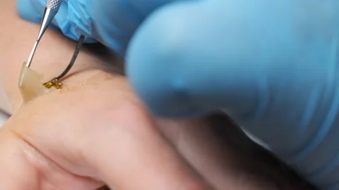 Microchip is implanted under skin on man hand Video stock 130345884