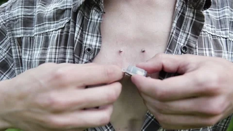 Microchipping human. microchip is implanted under skin on man hand close-up. Stock Footage 134932973