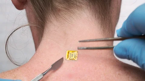 Microchipping Micro chip is Stock Video Pond5