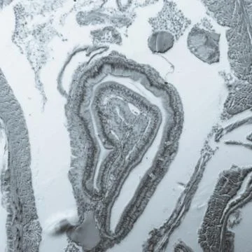 Micrograph earthworm crosscutting Foto stock