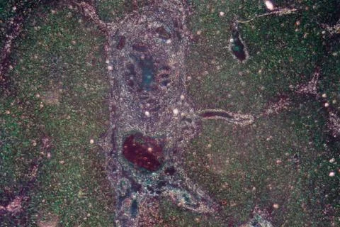 Micrograph of liver tissue 写真素材