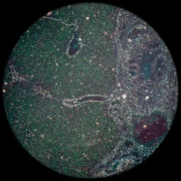Micrograph of liver tissue 스톡 사진