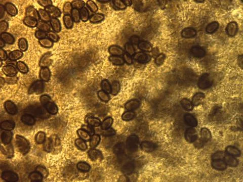 Micrograph showing a dense field of dark, oval, thick-walled fungal spores,.. Foto stock