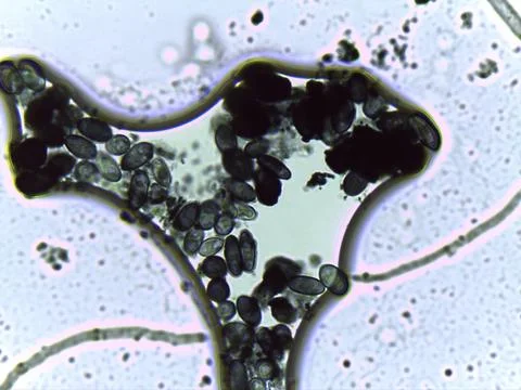 Micrograph showing a dense field of dark, oval, thick-walled fungal spores,.. 스톡 사진