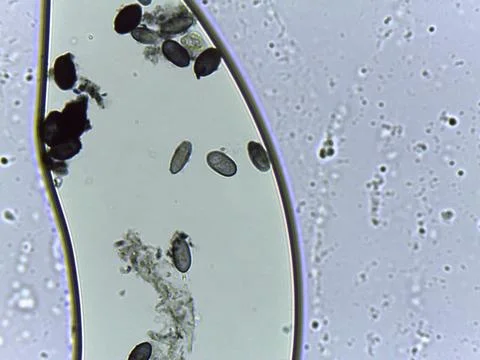 Micrograph showing a dense field of dark, oval, thick-walled fungal spores,.. Foto stock