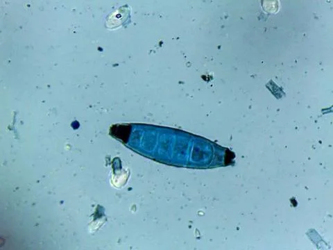 Micrograph showing large, canoe-shaped, blue-stained macroconidia of a derm.. Stock Photos
