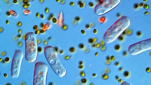 Microlife of protozoa àn algae under microscope,  pond water sample 스톡 동영상 318246823