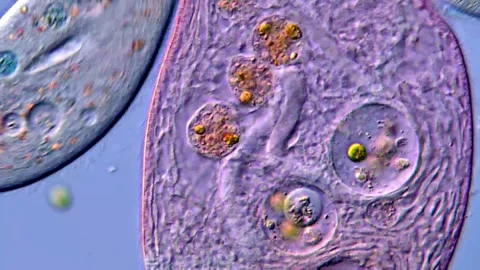 Microlife under microscope, Blepharisma protozoa 400x Vídeos de archivo 317633792