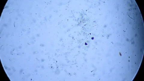 Microorganism Algae under the microscope Stock Footage 85526038
