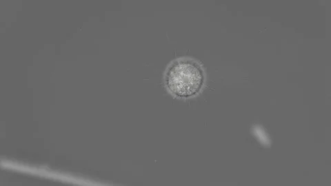 Microorganism Heliozoa, Acanthocystis under the microscope Stock Footage 92358022