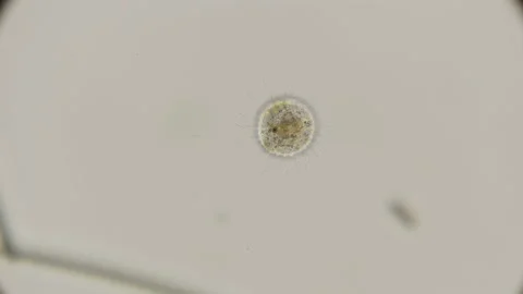 Microorganism Heliozoa, Acanthocystis under the microscope Stock Footage 92358860