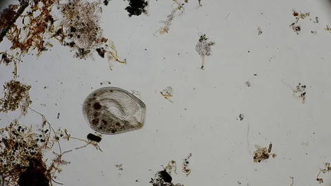 Unicellular Organisms Stock Videos – Royalty-Free HD & 4K Videos | Pond5