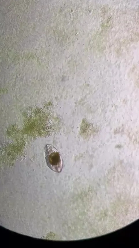 Microorganism Swimming Under Microscope in a Research Laboratory, China 库存影片 338209688