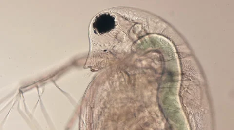 Microorganism under a microscope Stock Footage 32965508