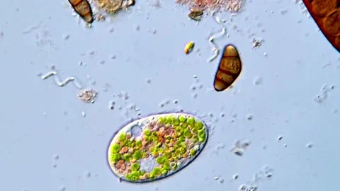 Microorganisms in Action: Ciliates Under Magnification, 400x Stock Footage 317886799