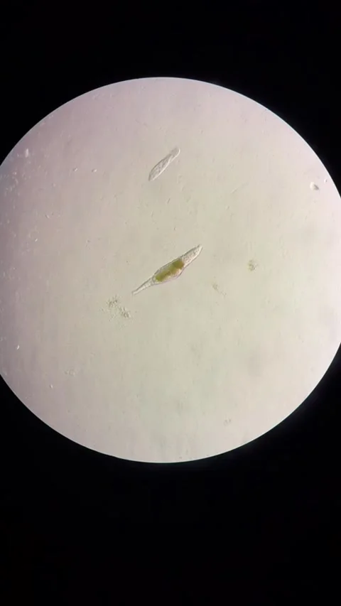 Microorganisms Actively Swimming Under Microscope in Chinese Lab Stock Footage 337915502
