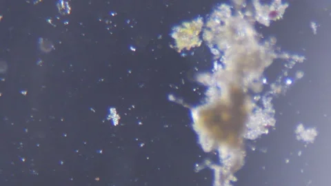 Microorganisms and algae in water river through an optical microscope Stock Footage 333240632