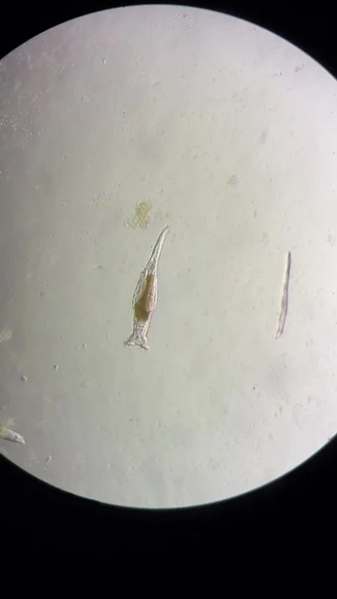 Microorganisms and Protozoa Clearly Visible Under a Microscope in a Chinese Lab Vídeo Stock 337915499
