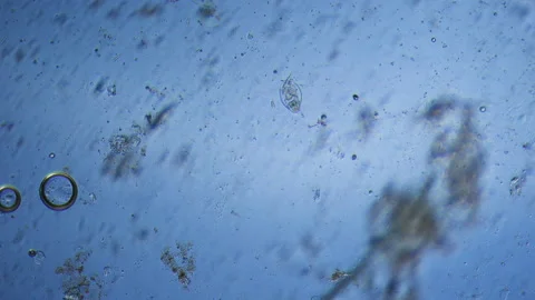 Microorganisms in flushing water from hands under a microscope. Hygiene Stock Footage 155368731