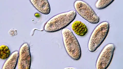 Microorganisms in Focus: Ciliates Under Microscope Vídeos de archivo 317885446